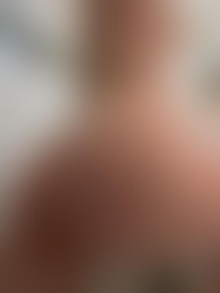 Album Malutrevejo
