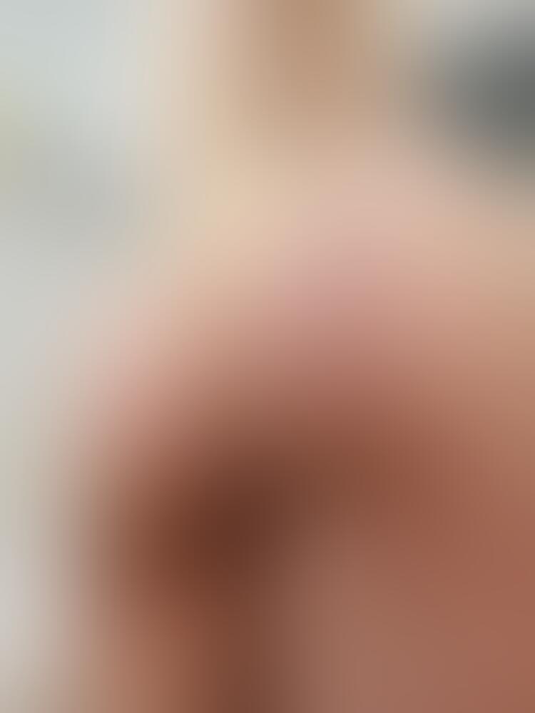 Album Malutrevejo