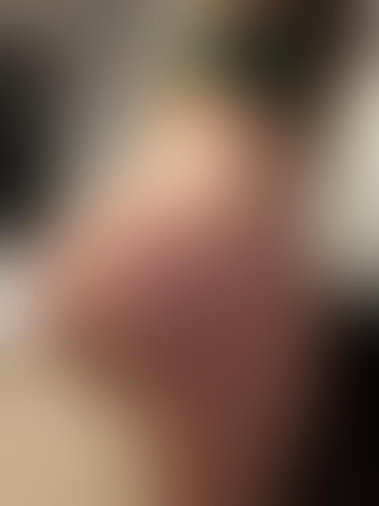 Album Malutrevejo