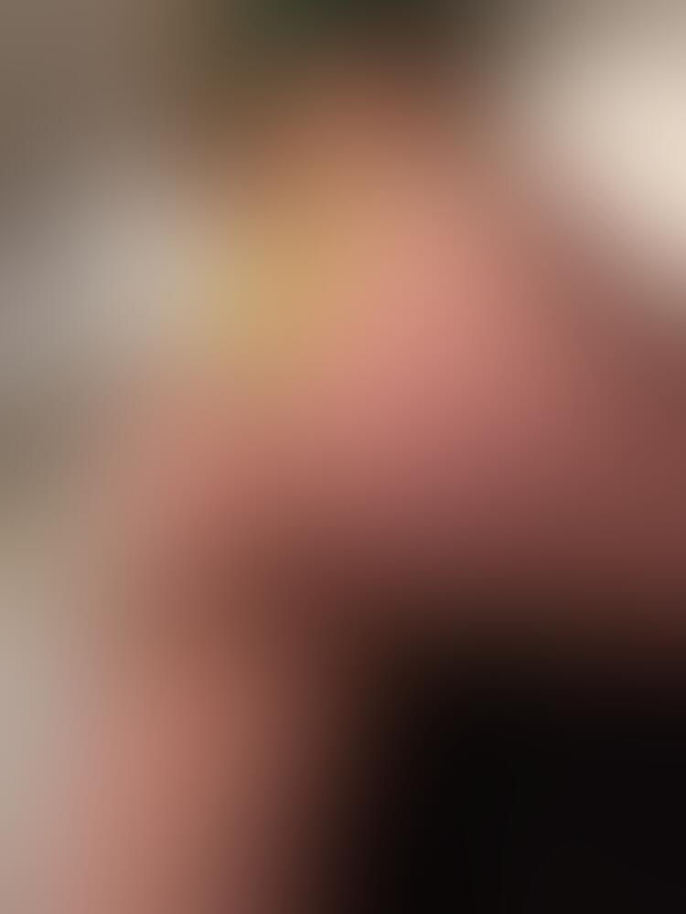Album Malutrevejo