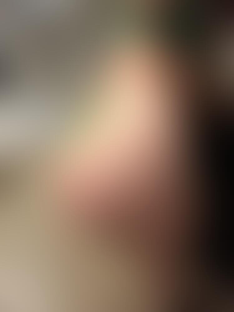 Album Malutrevejo