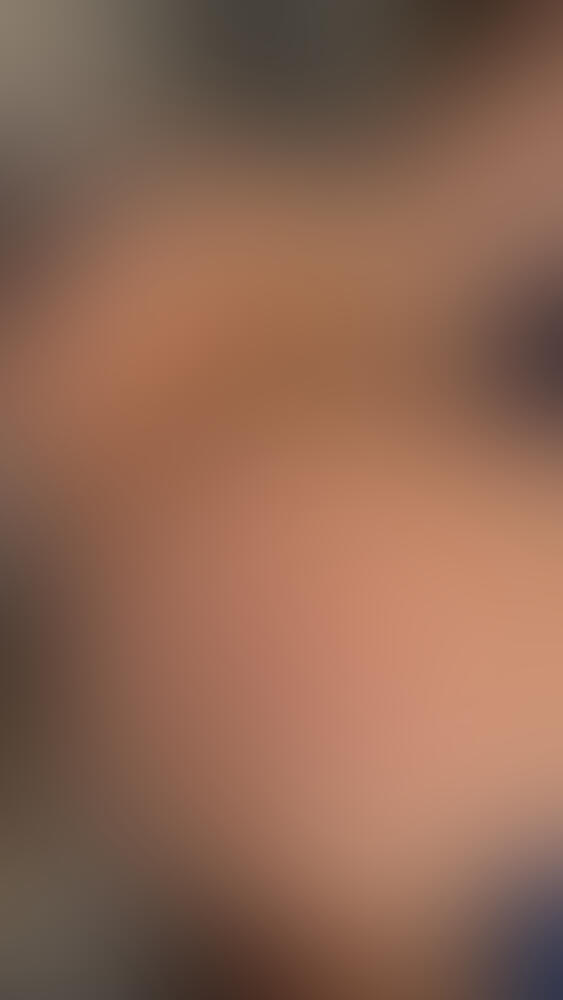 Album Malutrevejo