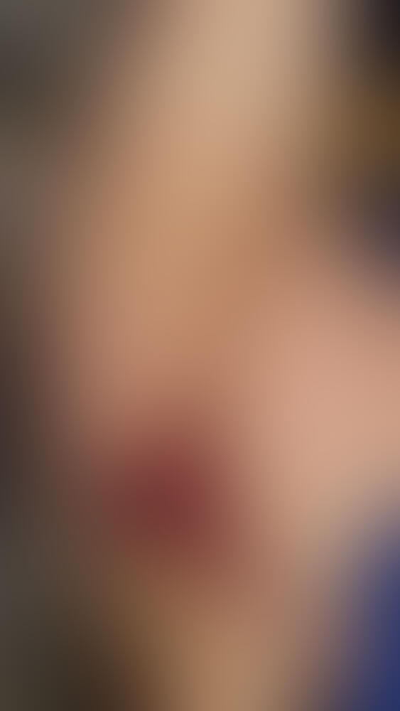 Album Malutrevejo